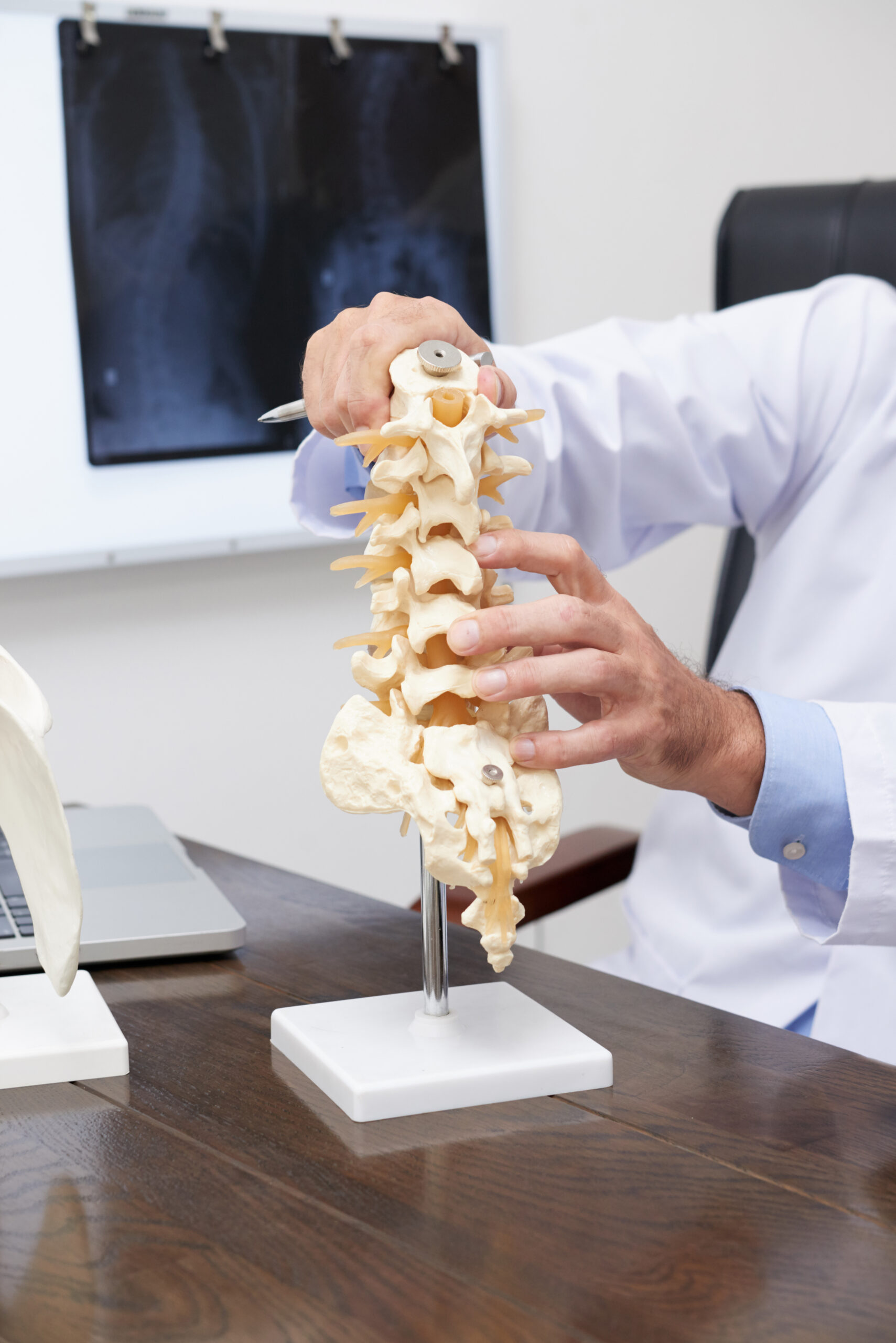 Spine model